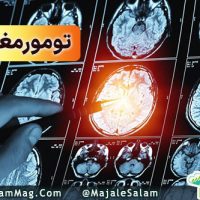 تومور مغزی چیست؟ انواع، علائم، علل و عوامل خطر 💟
